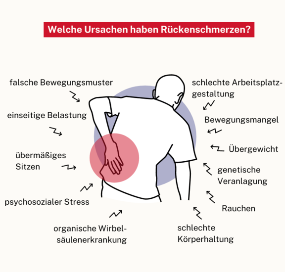 Ursachen für Rückenschmerzen | © ifb